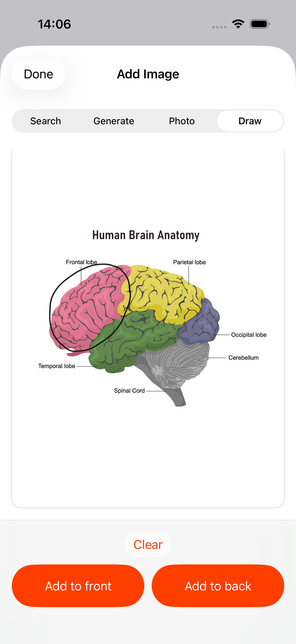 MasterKi drawing canvas with the frontal lobe circled on a brain diagram